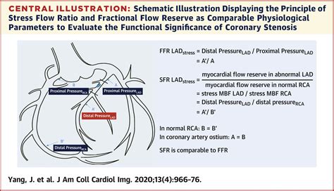 Stress Myocardial Blood Flow Ratio by Dynamic CT Perfusion Identifies ...