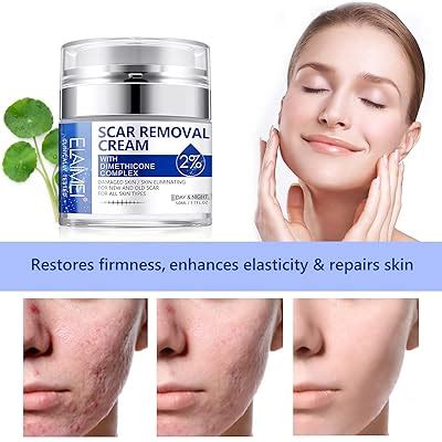 Worafy Scar Removal Cream for Old Scars, Natural Scar Cream India | Ubuy