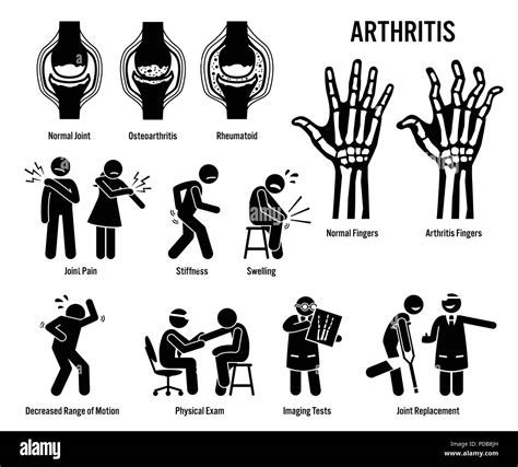Arthritis, Joint Pain, and Joint Disease Icons. Pictograms depict arthritis signs, symptoms ...