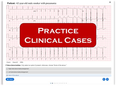 EKG Practice Course 的图像结果