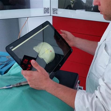 Image result for Peripheral Visual Field Defect