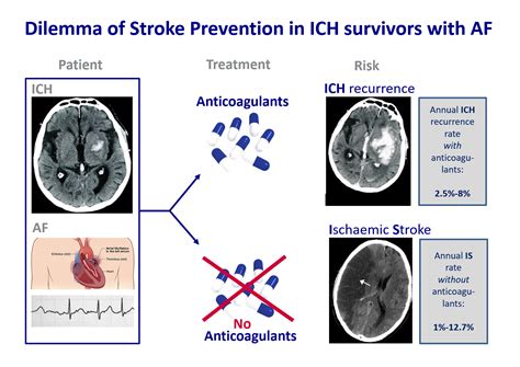 PREvention of STroke in Intracerebral haemorrhaGE survivors with Atrial Fibrillation | H2020 ...