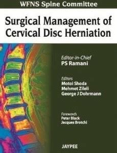 Surgical Management of Cervical Disc Herniation: Buy Surgical ...