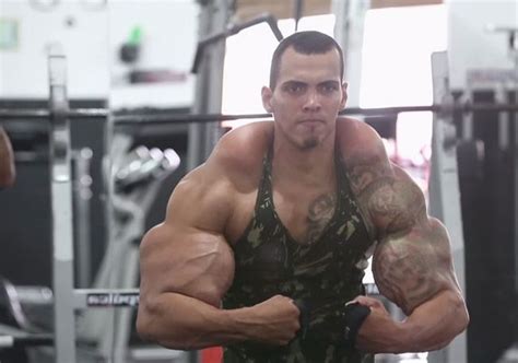 Known As The Hulk, This Man Almost Lost His Arms Because Of His Steroid ...