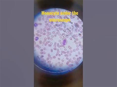 Image result for Monocyte Under Microscope