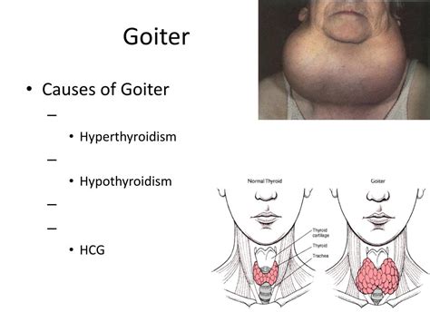 Image result for Thyroid Function Algorithm