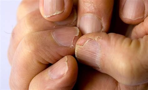 इन 4 तरह के तेलों से नाखून होते हैं लंबे, जानिए इनके नाम और इस्तेमाल ...