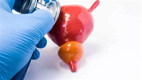 Managing Incontinence: Expert Tips and Insights | Friends Diaper