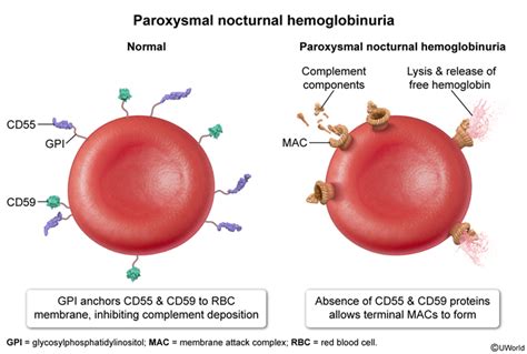 Image result for Complement System Disorders