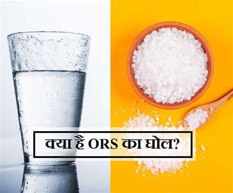 स्वास्थ्य विभाग वाराणसी में घर-घर पहुंचाएगा ओआरएस के पैकेट, 14 अगस्त तक ...