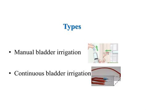 Bladder irrigation | PPTX
