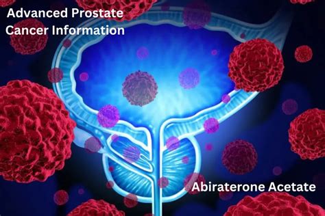 Advanced Prostate Cancer Life Expectancy 的图像结果
