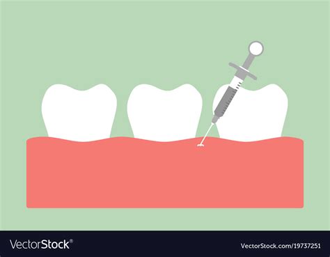 Image result for Tooth Extraction Injection