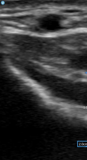 Image result for Ultrasound Scanner Depth Control