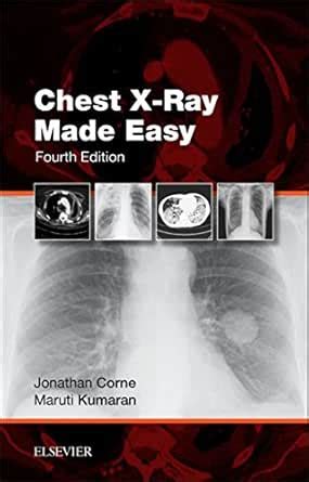 Chest X-Ray Made Easy: Chest X-Ray Made Easy E-Book eBook : Corne ...