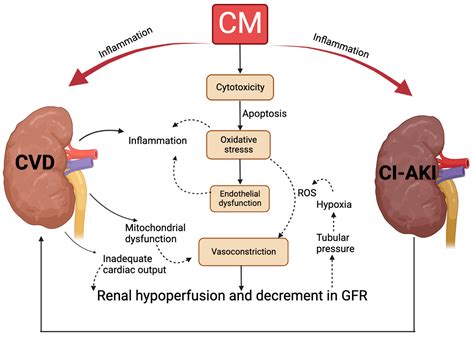 The Potential Biotherapeutic Targets of Contrast-Induced Acute Kidney Injury