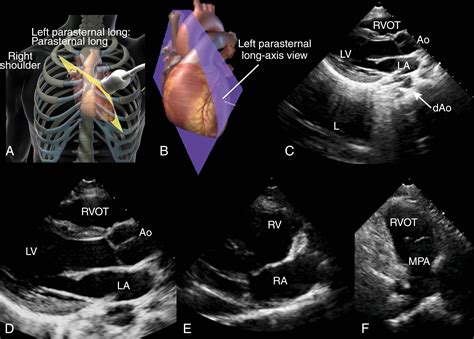 Transthoracic Echocardiography Tomographic Views - Clinical Tree