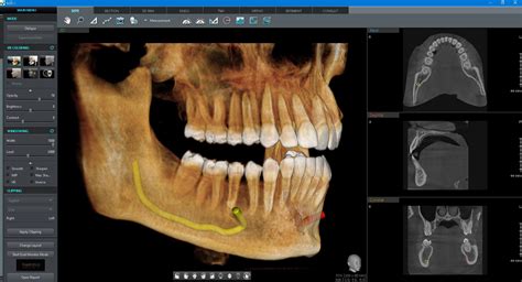 New Page Indianapolis IN, Fall Creek Family Dental