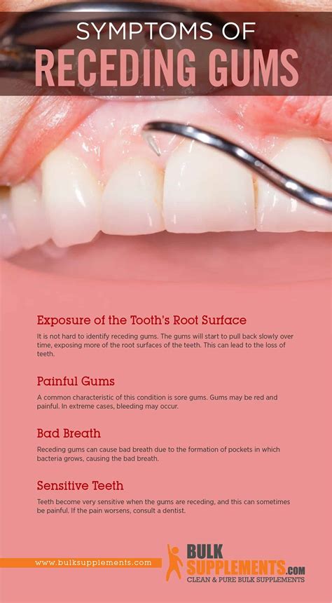 Receding Gums: Symptoms, Causes & Treatment