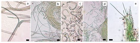 Cyanobacterial Communities of Carbonate Sediments and Biomineralization ...