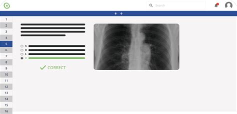 Image result for Algorithms for USMLE Step 1