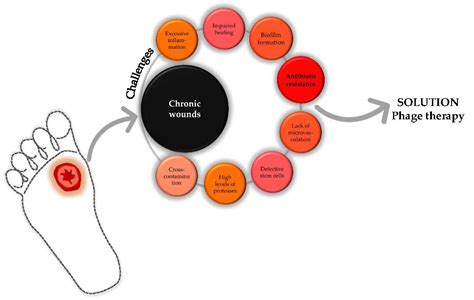 Bacteriophages for Chronic Wound Treatment: From Traditional to Novel ...