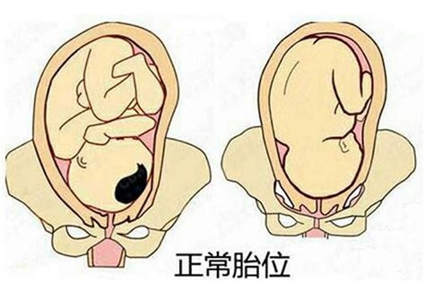 胎方位简易图,胎方位图片示意图 - 伤感说说吧