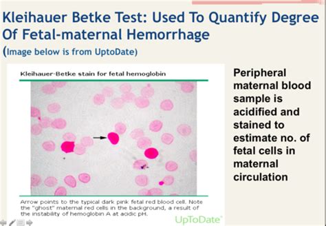 Image result for Fetal Bleed Screen Kit Parallel Testing