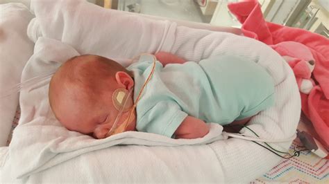 Baby Born At 34 Weeks - Baby Viewer