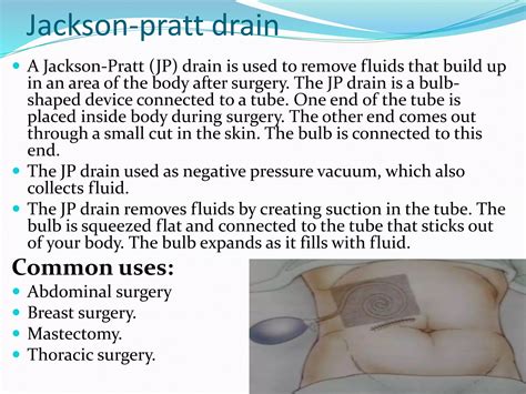 Surgical drains | PPTX