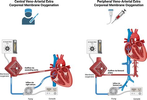 Unloading the Left Ventricle in Venoarterial ECMO: In Whom, When, and ...