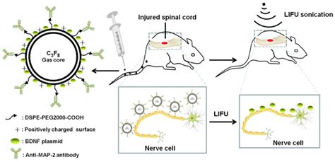 Bubble-Based Drug Delivery Systems: Next-Generation Diagnosis to Therapy