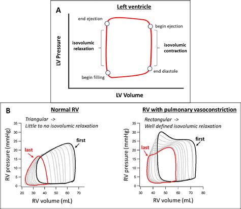 Right Ventricular Pressure Waveform Analysis—Clinical Relevance and ...