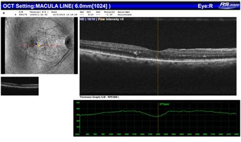 Department of Ophthalmology - Chettinad Academy
