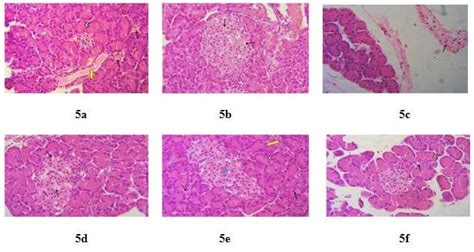Antihyperglycemic, antihyperlipidemic and antioxidant effect of ...