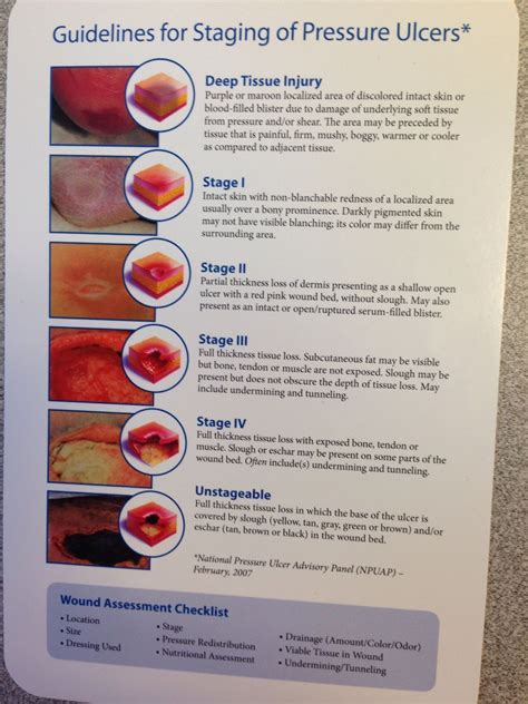 Pressure ulcer stages | Wound care, Pressure ulcer, Nursing school survival