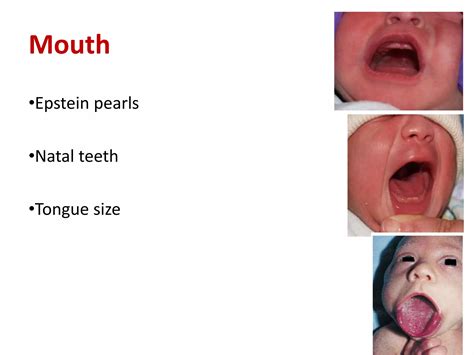 Examination of newborn. | PPTX