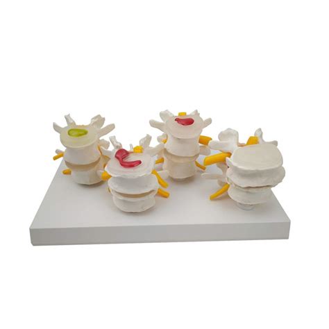 Buy Torso Heart Brain Skeleton Medical School Education Lumbar Vertebra ...