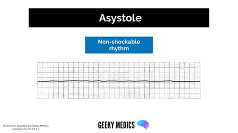 Shockable vs. Non-shockable Rhythms in Cardiac Arrest | Geeky Medics