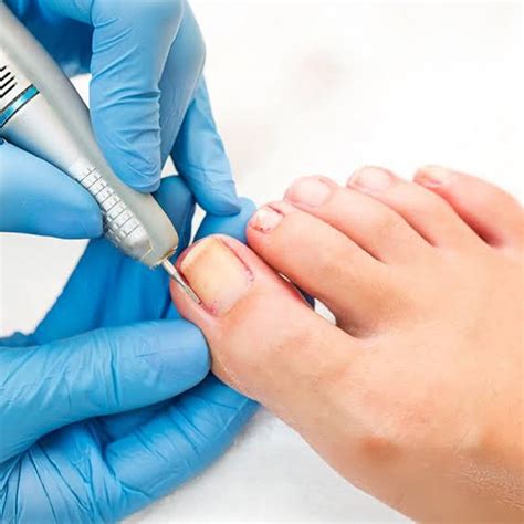 Dermato Surgery – Prime Derm