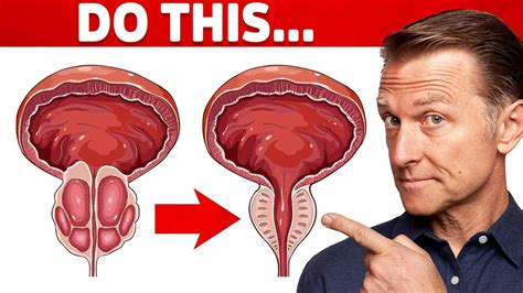 Image result for Enlarged Prostate Medication