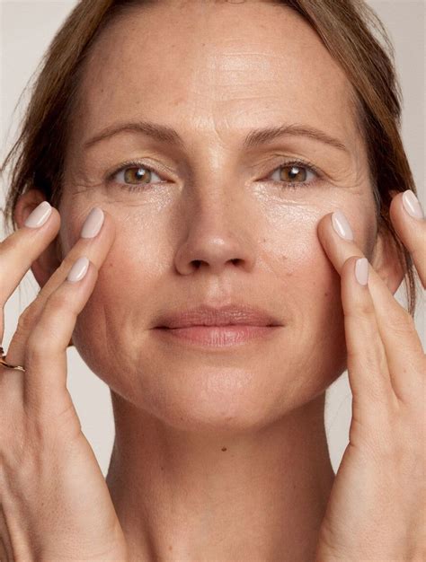 under eye psoriasis