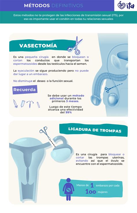 Métodos anticonceptivos definitivos | ITA