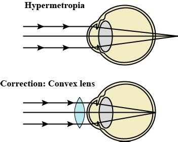 Notes of Human Eye and Colourful World Class 10