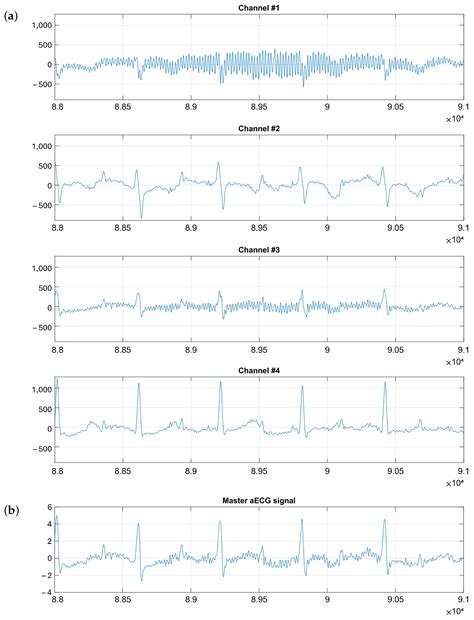 PCA-Based Preprocessing for Clustering-Based Fetal Heart Rate ...