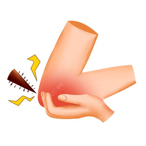 Gout Hd Transparent, Schematic Diagram Of Joint Gout Elbow Gout, Joint, Gout, Dumpling Elements ...