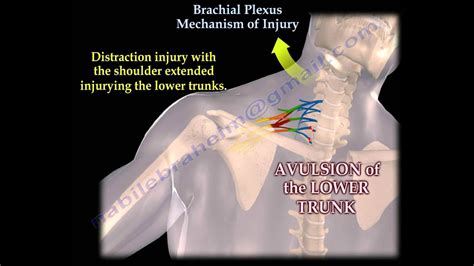 Image result for Non-Routine Task Signs