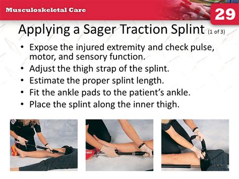 Hare Traction Splint Application 的图像结果