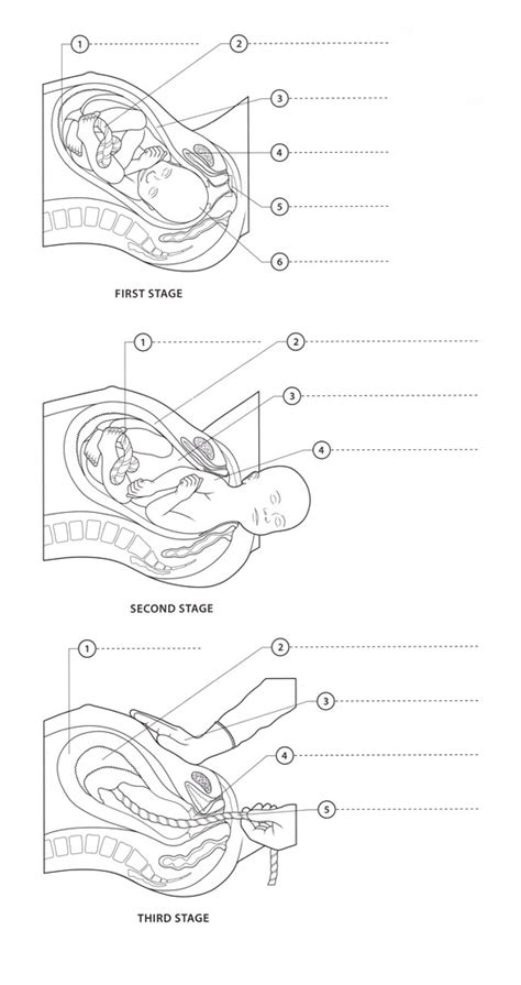 Labor 的图像结果