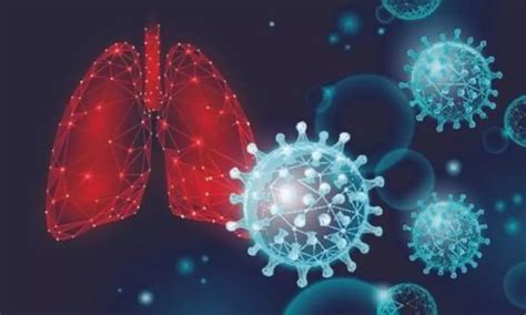 Is there a link between Covid-19 and lung cancer? Experts explain